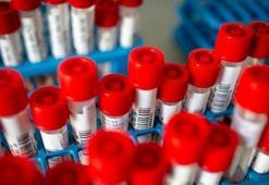 Corona virüs testi yaptıranlar sonuçlara "eNabız"dan ulaşabilecek