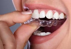 Ortodontik tedavi metodu invisalign