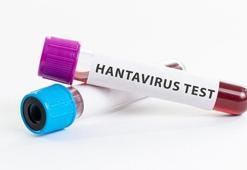 Hanta virüsü (hantavirüs enfeksiyonu) nedir, belirtileri nelerdir? Hanta Virüsü nasıl bulaşıyor? Çin'de yeni virüs ortaya çıktı!