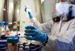Nobel ödüllü doktor corona virüsün nasıl ortaya çıktığını açıkladı