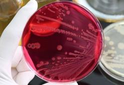 Fransa'da Salmonella bakterisi alarmı!