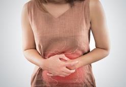 Kolit nedir, belirtileri nelerdir? Kolit (bağırsak iltihabı) nedenleri ve tedavi yöntemleri