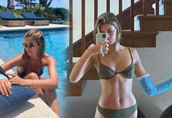 Model Kaia Gerber kolunu kırdı