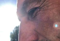'Gök taşını izlerken gözümden rahatsızlandım'