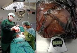 Doktorlar şoke oldu! Ağrı ve kanama şikayetiyle gitti...