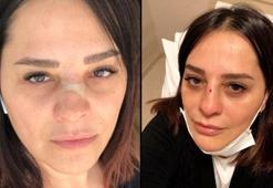 Reyhan Karaca korkuttu! Kanlar içinde kaldı