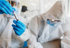 PCR ve Antikor testlerinin farkları nelerdir? PCR ve Antikor testleri hangi sonuçları veriyor?