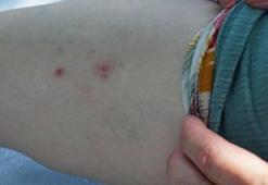 Dirençleri arttı, ilaçlar da fayda etmiyor! Yeni kabus sivrisinek...