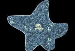 Amip nedir, Amip nasıl ürer? Amip belirtileri ve tedavisi! Beyin yiyen amip nedir?