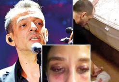 Rubato solisti Özer Arkun sevgilisini hastanelik etti! 'Hayatımda böyle kan görmedim'