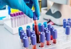 “Viral hepatitler toplum sağlığını tehdit ediyor”