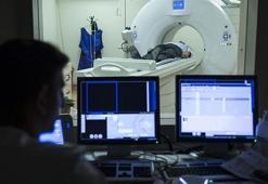2040'a kadar Parkinson hastası sayısının 18 milyona  ulaşması bekleniyor