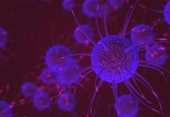 Huntington hastalığı nedir? Huntington hastalığı neden olur, tedavisi var mı? Huntington hastalığı belirtileri…