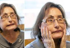 ABD’de ilk yüz nakli yapılan Connie Culp hayatını kaybetti