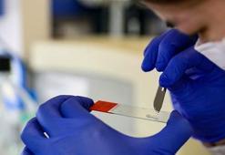 Dünya Kovid-19 aşısını geliştirmek için seferber oldu