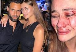 Ukraynalı model Daria Kyryliuk'ı kim darbetti? Görgü tanıkları anlattı