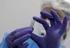 15 dakikada sonuç veren hızlı Kovid-19 antijen testi  üretilecek