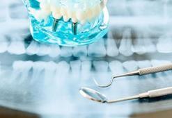 'Diş implantı, hayat kalitesini artırıyor'