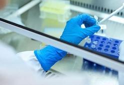 Bursa'da nano-solüsyon çalışması sonuç verdi