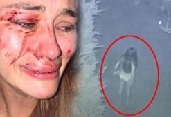 Dayak yiyen Ukraynalı modelin soruşturmasında flaş gelişme