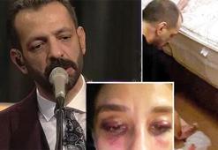 Rubato solisti sevgilisini darp etti! 35yıl hapsi isteniyor