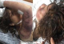 Dehşet evi! Eşini zincirle dövüp, tırnaklarını çekerek işkence yaptı