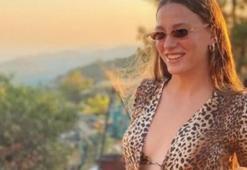 Serenay Sarıkaya göğüs estetiği mi yaptırdı?