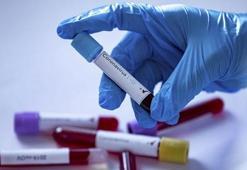 Aşk hormonu oksitosin Kovid-19'un tedavisi için potansiyel taşıyor