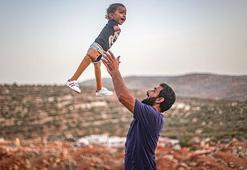 Muhammed bebek, protez bacaklarıyla İdlib'e döndü