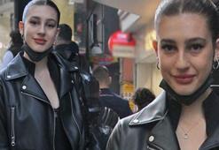 Itır Esen'den 'dudak dolgusu' yanıtı
