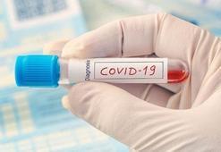 Prof. Dr. Çilingiroğlu, Covid-19 tedavisinin bulunduğunu iddia etti