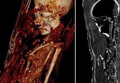 Bilgisayarlı tomografi mumyaların sırlarını ortaya çıkardı