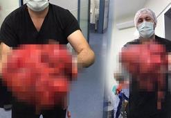 Doktorlar şoke oldu! Karın ağrısı şikayetiyle gitti...