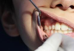 Diş sıkma alışkanlığı masseter botoks tedavisiyle son buluyor