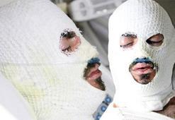 Çay evinde korkunç olay! İki genç bu hale geldi