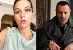 Deniz Bulutsuz: Kendimi çok kötü hissediyorum