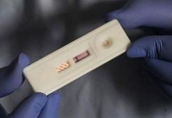 AIDS ile ilişkili hastalıklara bağlı ölüm oranları azaldı