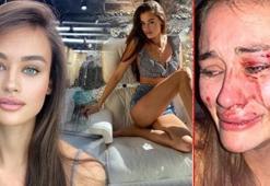 Türkiye günlerce bu olayı konuştu! Ukraynalı mankenden şaşırtan karar