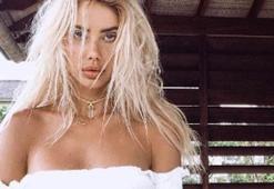 Sahara Ray gündem oldu! 'Dudağımı köpek ısırdı' dedi ama...