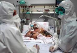 Dünya genelinde Kovid-19 vaka sayısı 84 milyonu geçti