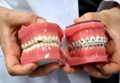 'Şeffaf plak' uygulaması 'diş teli' tedavisinin zahmetinden kurtarıyor