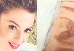 Esra Mansuroğlu estetik merkezine gitti! Hayatı kabusa döndü