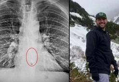 Şok eden olay! Uykusunda yuttu, sabah nefes alamadığında anladı...