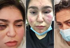 Alman polisinden Türk aileye şiddet! Kızı konuşamıyor, kendisi...