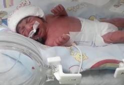 1 kilo 300 gram doğdu, hayata tutundu!