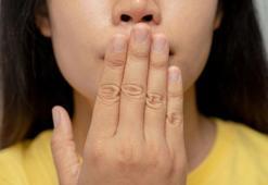 Ağız kokusu deyip geçmeyin! Nedeni sinsi hastalık olabilir!