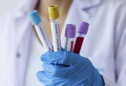 Biontech aşısı geldi mi? Biontech aşısı nedir, hangi ülkenin, kimlere verilecek? İşte aşının özellikleri…