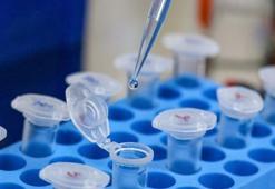DNA incelenmesinde kullanılan "boyut belirteci"  geliştirildi