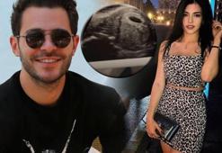 Aygün Aydın'dan 'hamileyim' iması! Ultrason görüntüsünü paylaştı: 3 aylıkmış