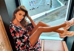 Özge Ulusoy'dan estetik itirafı! 'Muazzam bir iş çıkardı'